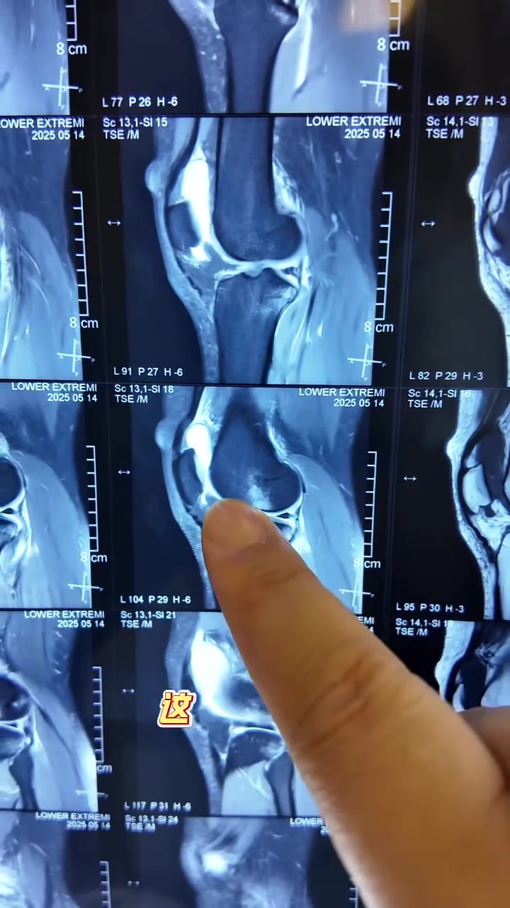 麦迪逊韧带受伤短期缺阵引球队战术担忧的简单介绍